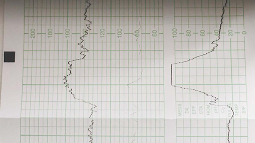 Image of a data graph © Stephen Andrews/Unsplash
